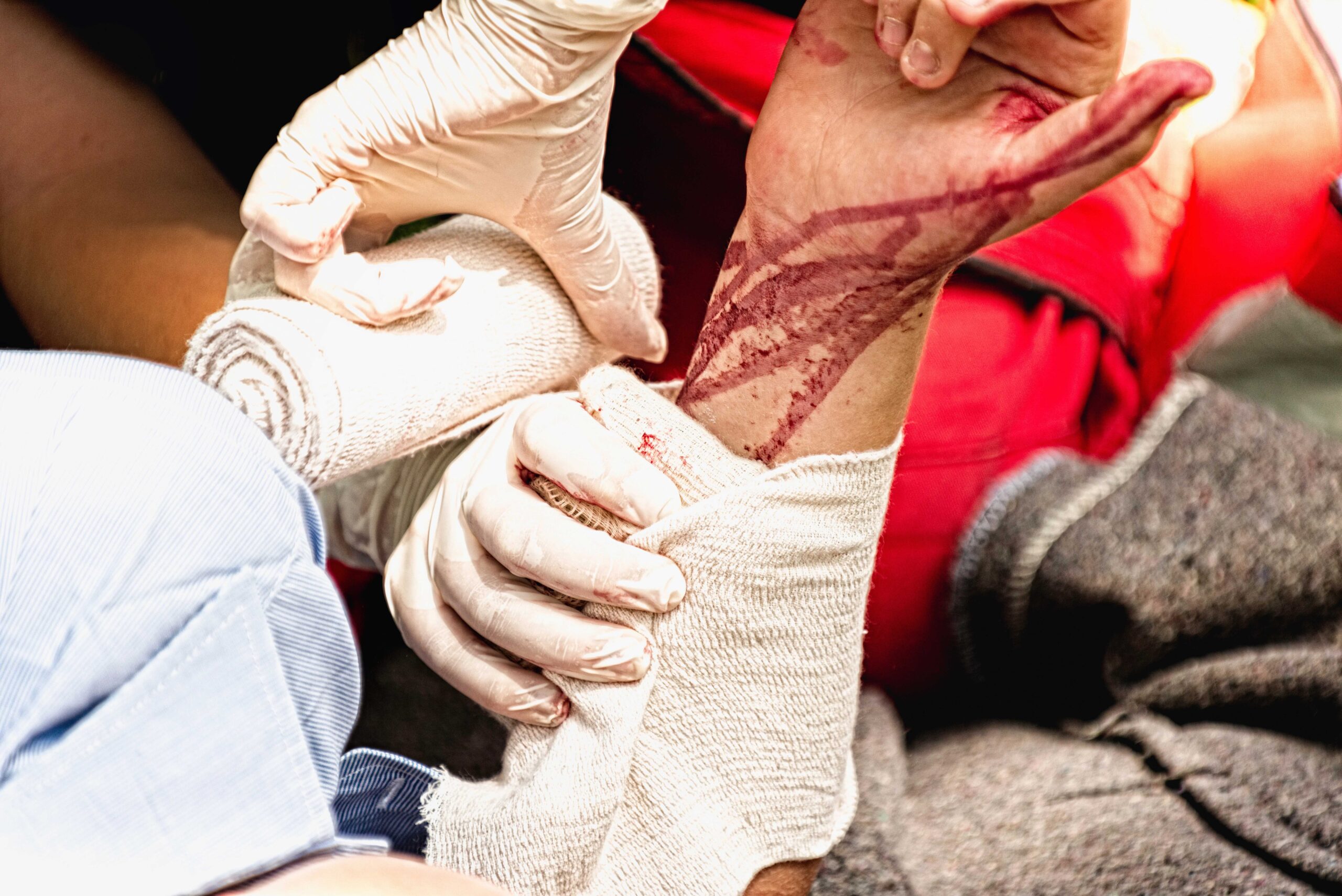 ЗУПИНИ КРОВОТЕЧУ! (STOP THE BLEED)